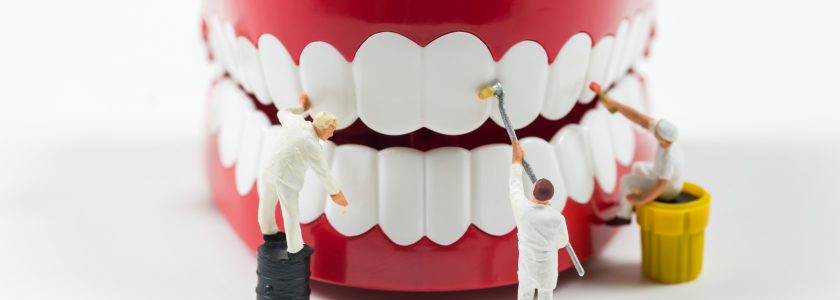 Cuida tus implantes dentales para garantizar su durabilidad