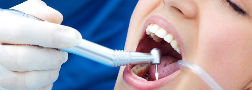 Causas y tratamientos de la periodontitis