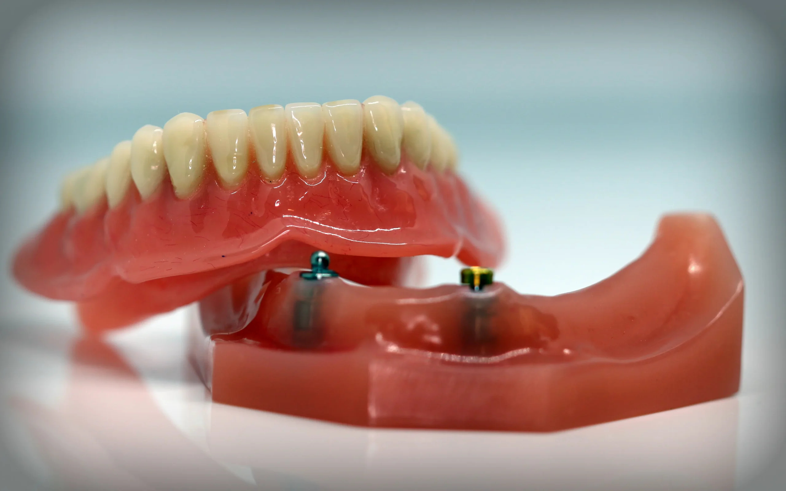 Protesis Dental